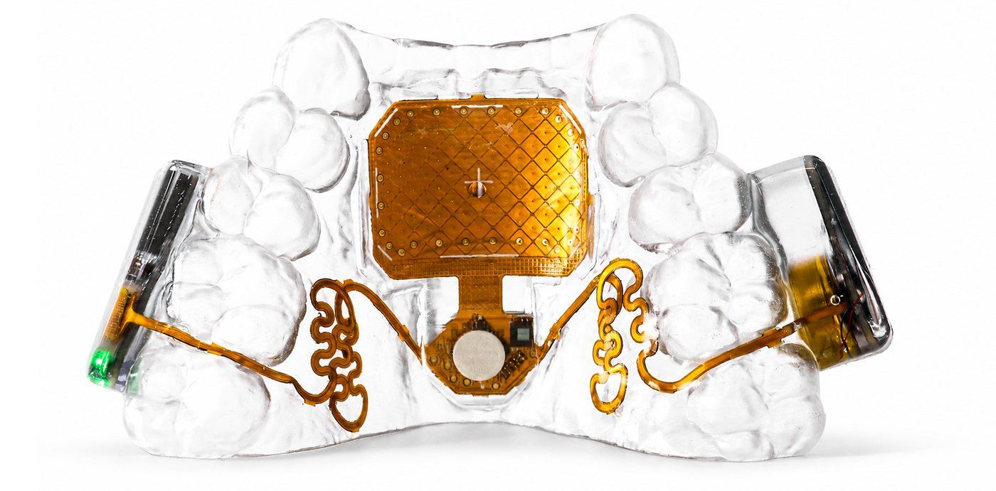 MouthPad by Augmental: a clear custom-fit retainer with a gold palate trackpad and small side electronics modules.