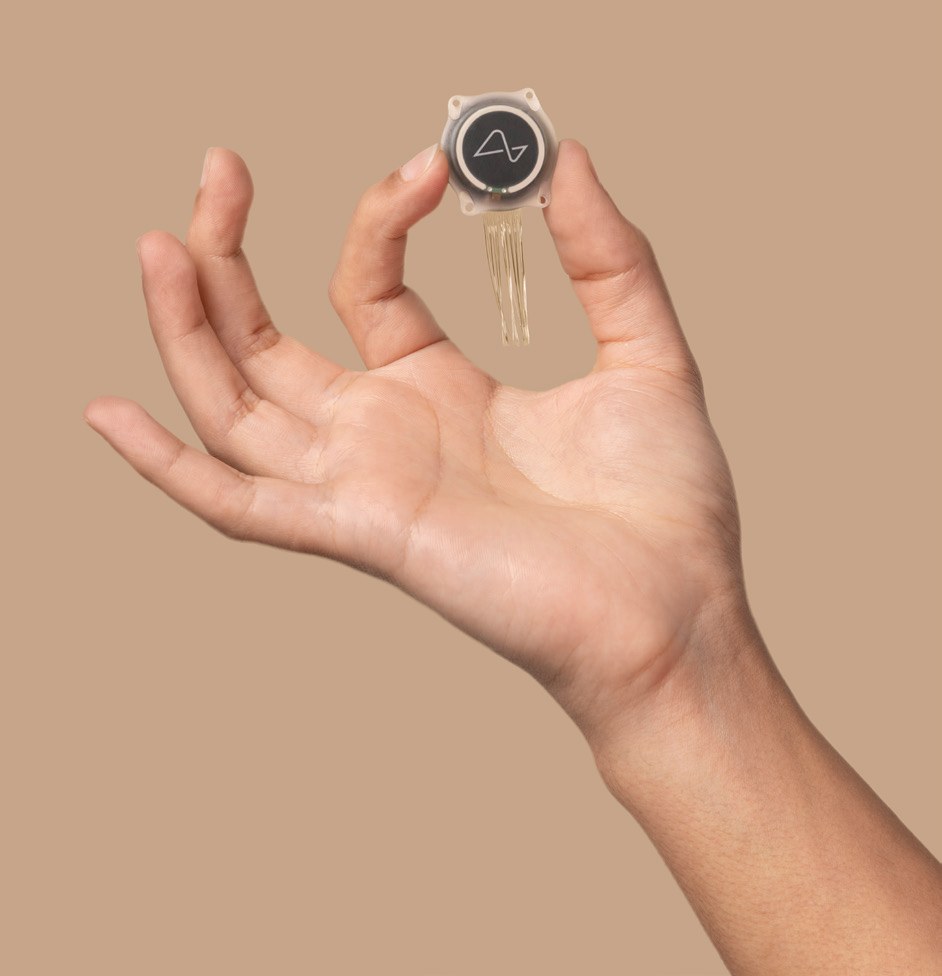 Neuralink N1 implant held in a hand: a coin-sized device with electrode threads.